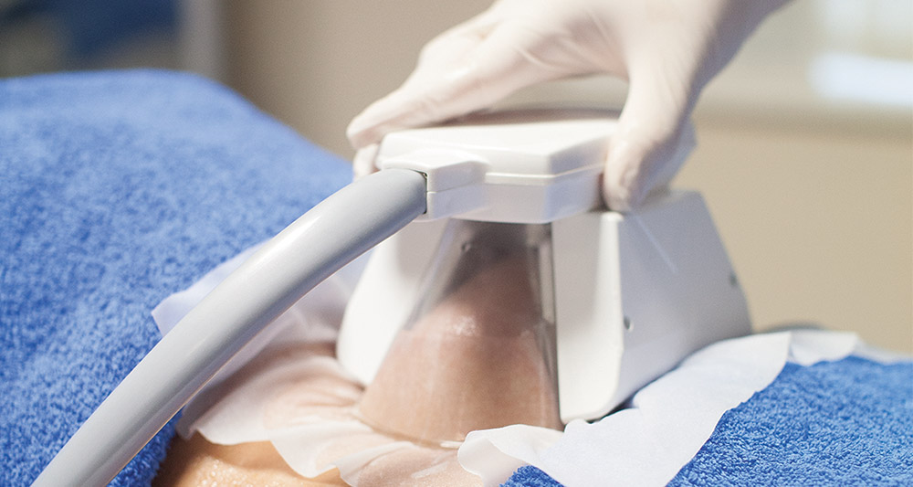How Fat Freezing and HIFU Work Together? 2 Multiple Areas in One Session HIFU and Fat Freezing Borehamwood