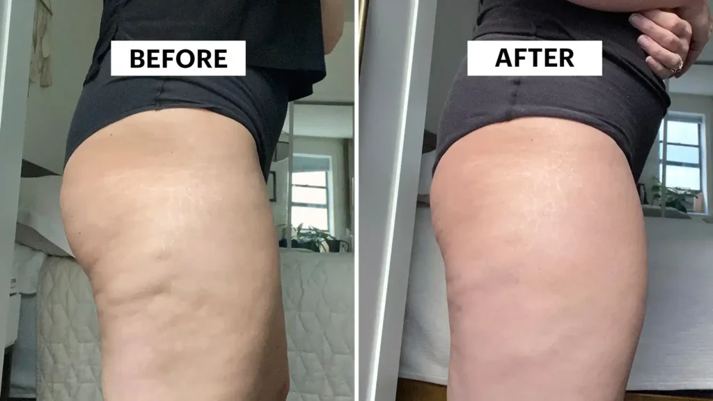 Sculpting Your Bum: Can Toning Exercises Really Reduce Cellulite? 1 Do Toning Exercise Borehamwood Really Tackle Cellulite?