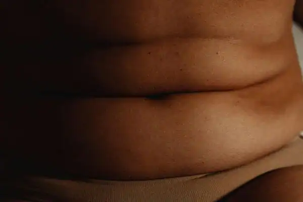 The Hidden Connection: How Stress Shapes Your Fitness and Body Composition 3 image of what stress can do on the stomach area and how Lipo 360 Borehamwood can help to change your body shape.