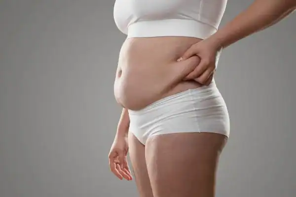 Image of stress belly Borehamwood How Lipo 360 can help manage your symptoms